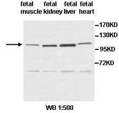 PDE3A Antibody (aa609-901)