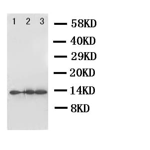 Polyclonal Rabbit anti-Human IL4 Antibody (aa72-98, WB)
