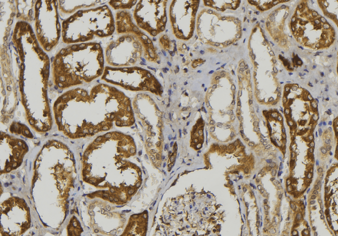 Polyclonal Rabbit anti-Human ADAMTS1 Antibody (IHC, IF, WB)