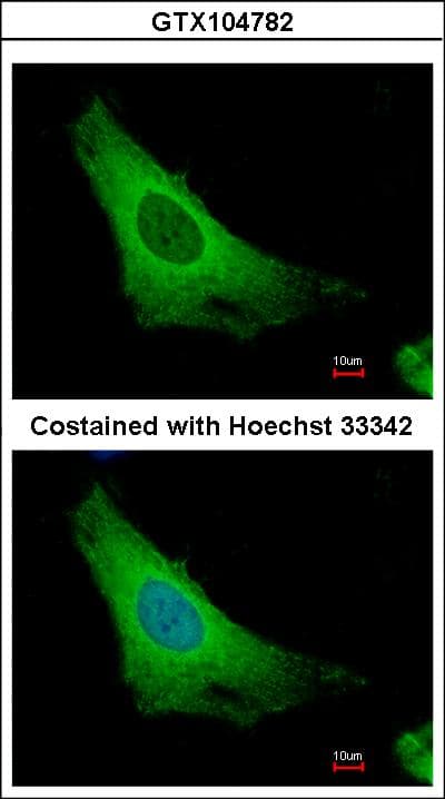 ARF3 Antibody (aa15-181)