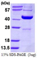 Human DCPS Protein (Recombinant His)