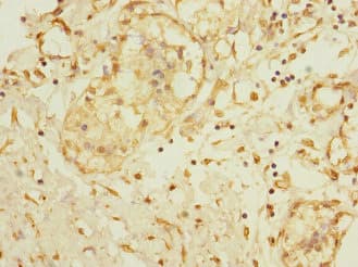 ADAM28 Antibody