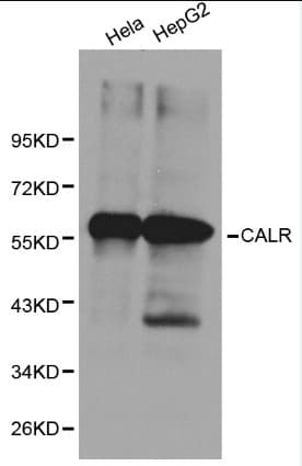CALR / Calreticulin Antibody