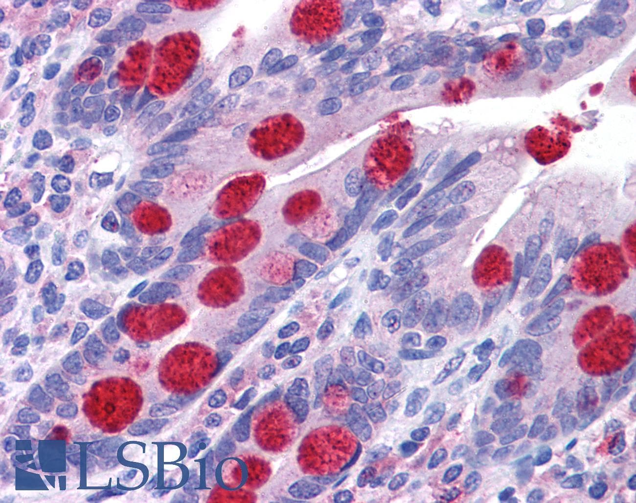 IHC-plus™ Polyclonal Rabbit anti-Human ZCRB1 Antibody (IHC, WB)