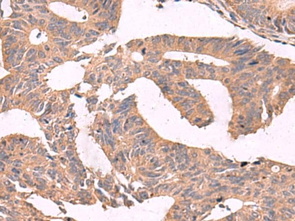 MGP / Matrix Gla-Protein Antibody