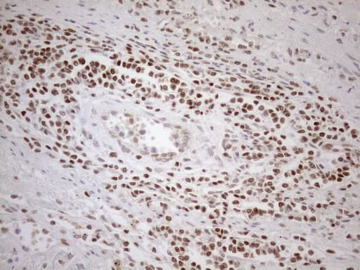 MGMT Antibody (clone OTI2E2, Carrier-free)