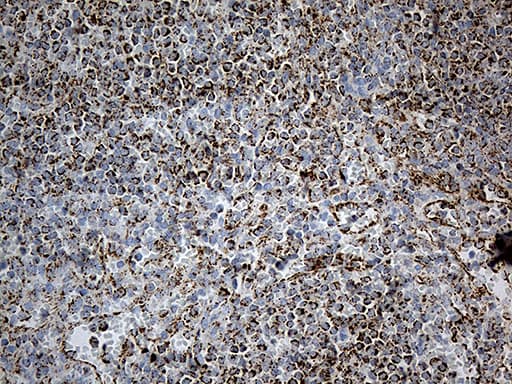Monoclonal Mouse anti-Human MCAD / ACADM Antibody (clone OTI9G10, Carrier-free, IHC, WB)