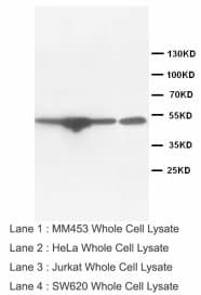 EDNRB / Endothelin B Receptor Antibody (Internal, Sepharose)
