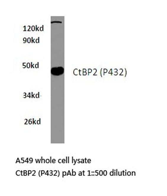 CTBP2 Antibody (Pro432)