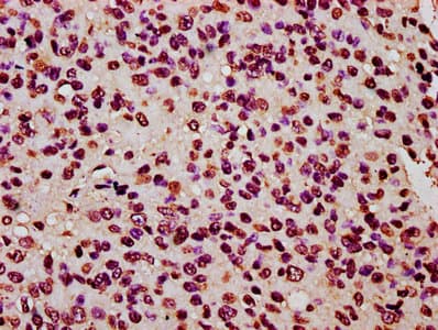HIST1H2BN Antibody