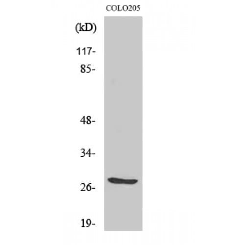 TNFSF12 / TWEAK Antibody (10-90 aa, Internal)