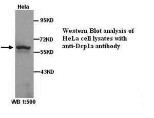 Polyclonal Rabbit anti-Human SMIF / DCP1A Antibody (WB)