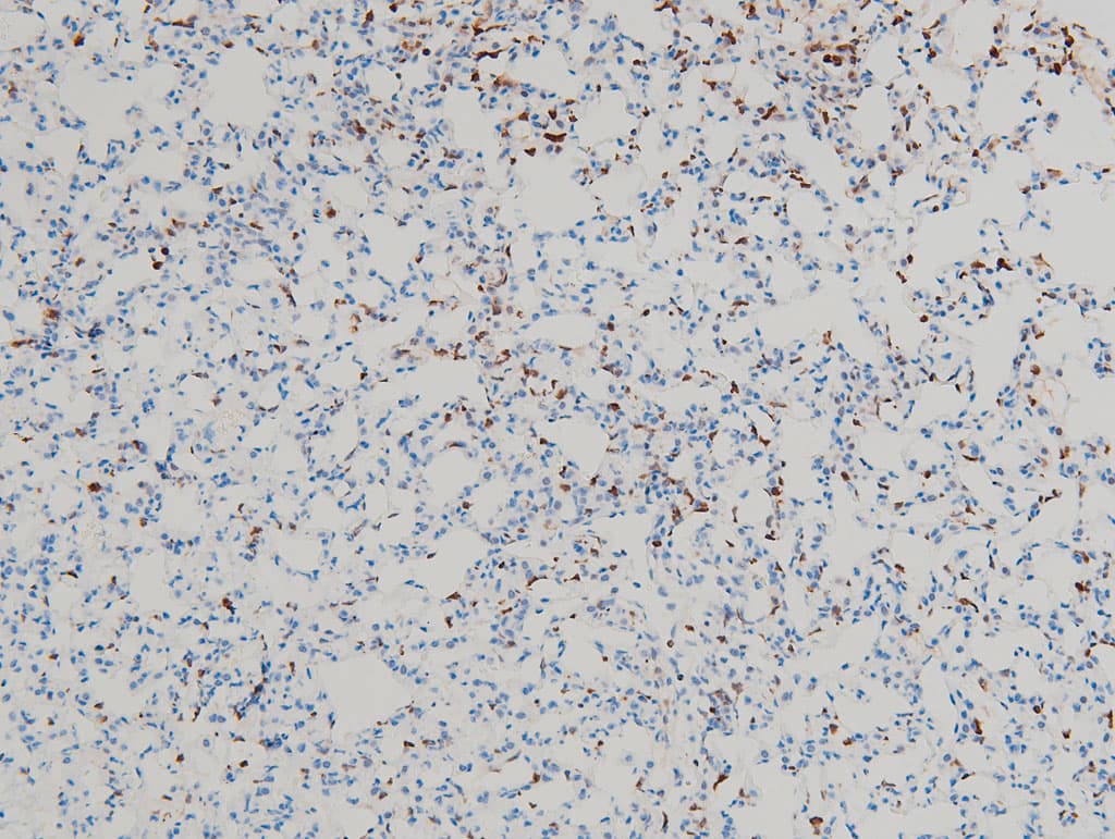 CFL1 / Cofilin Antibody (phospho-Ser3)