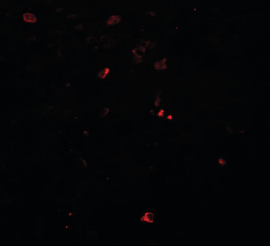 IHC-plus™ Polyclonal Rabbit anti-Human BCAS3 Antibody (IHC, IF, WB)
