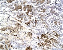 ADM / Adrenomedullin Antibody