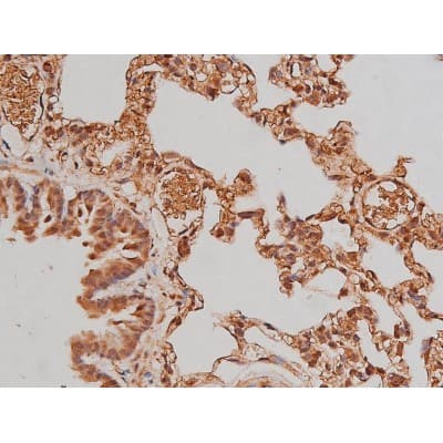 MAPT / Tau Antibody (phospho-Ser262)