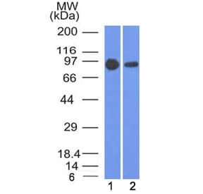 CTNNB1 / Beta Catenin Antibody (clone 5H10)