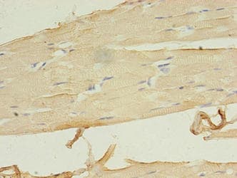 LRRN1 Antibody (aa26-631)