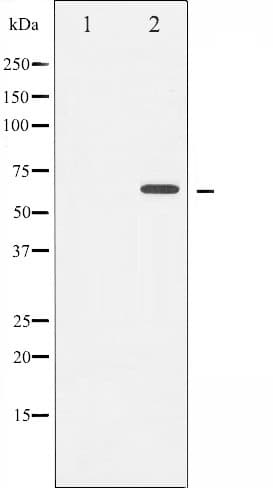 Polyclonal Rabbit anti-Human CHEK2 / CHK2 Antibody (IHC, IF, WB)
