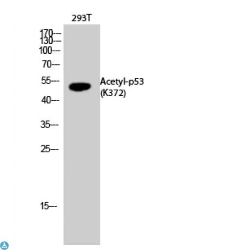 TP53 / p53 Antibody