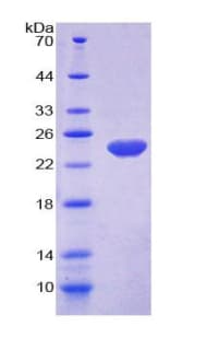Bovine NOS3 / eNOS Protein (Recombinant His-T7)
