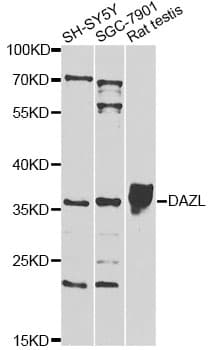 Polyclonal Rabbit anti-Human DAZL Antibody (IHC, IF, WB)
