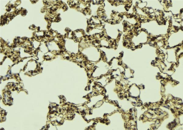 DAXX Antibody (phospho-Ser668)