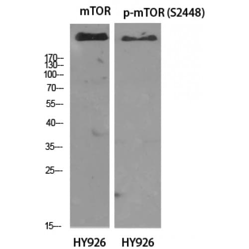 Polyclonal Rabbit anti-Human MTOR Antibody (pS2448, IHC, IF, WB)
