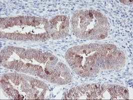 IRF6 Antibody (clone OTI2C10, Carrier-free)