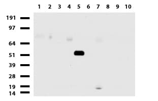 Monoclonal Mouse anti-Human GFAP Antibody (clone UMAB129, IHC, IF, WB)