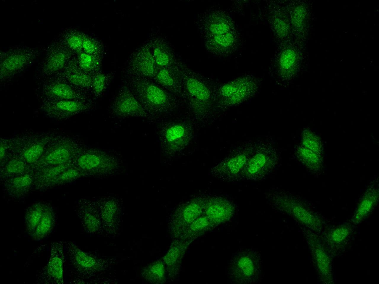 MBNL2 Antibody