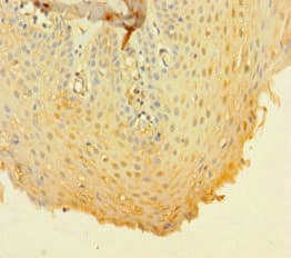 CD14 Antibody