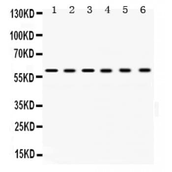 Polyclonal Rabbit anti-Human TCP1 Antibody (aa515-551, IHC, WB)