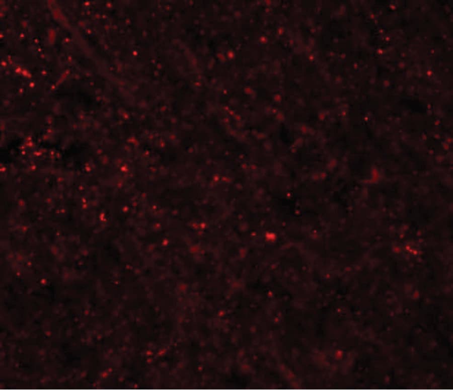 IHC-plus™ Polyclonal Rabbit anti-Human FRMPD3 Antibody (IHC, IF, WB)