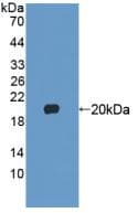 Mouse FGF22 Protein (Recombinant His, N-Terminal)