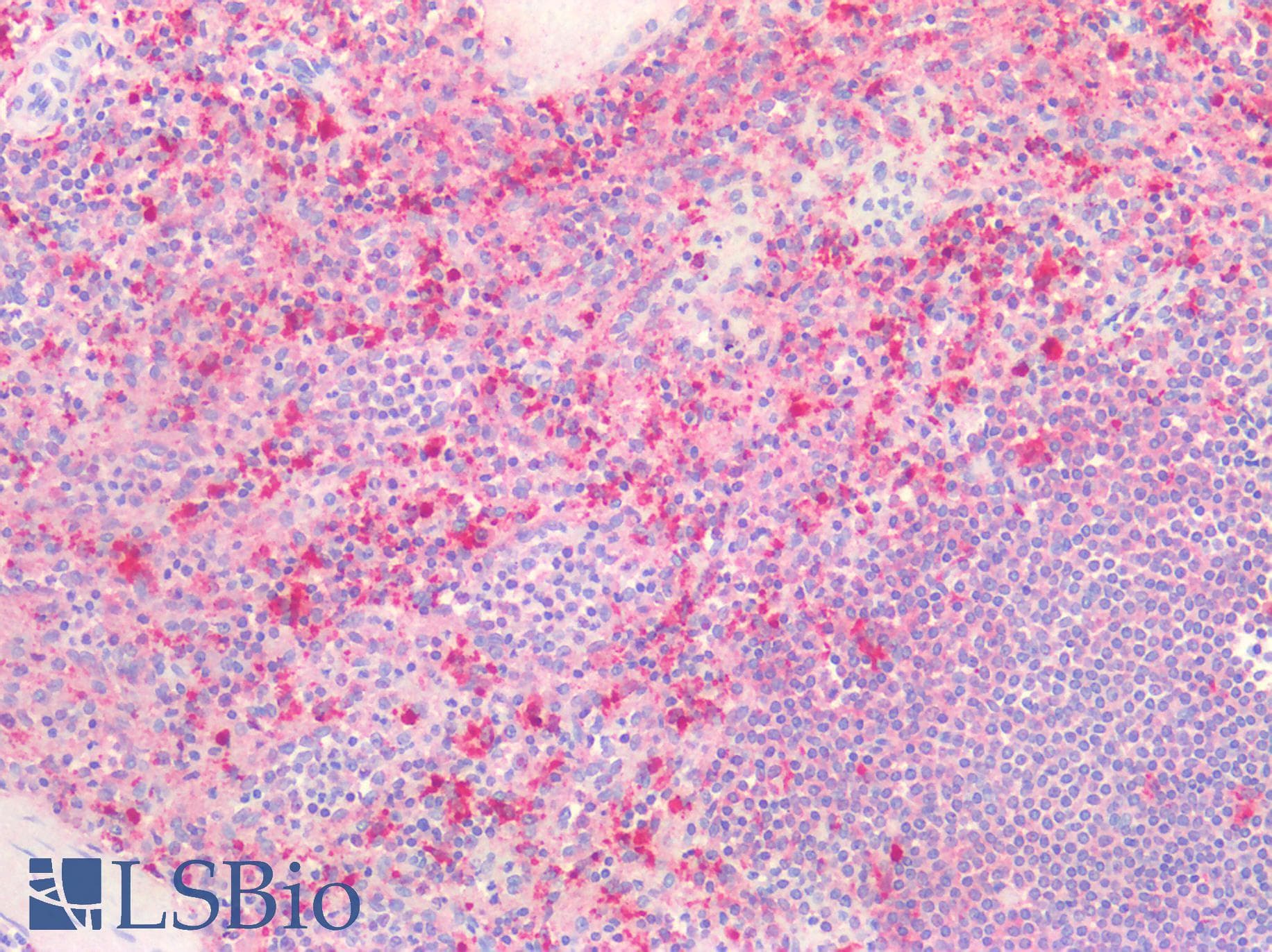 PathPlus™ Polyclonal Rabbit anti-Human CTSB / Cathepsin B Antibody (Internal, IHC, WB)