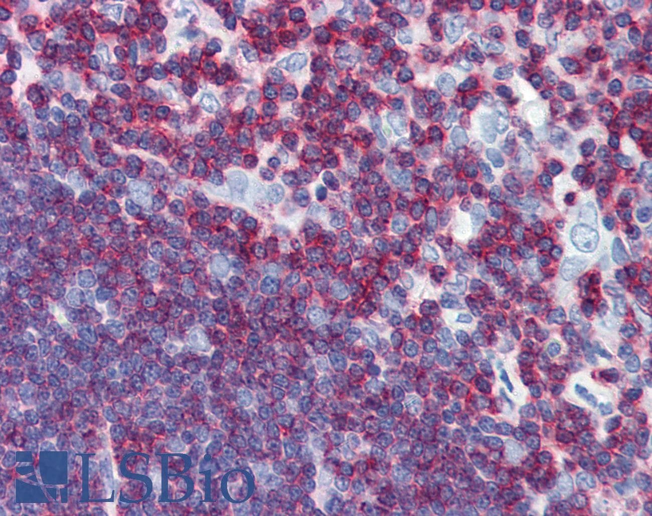 IHC-plus™ Monoclonal Mouse anti-Human CD45 / LCA Antibody (clone 3G4, aa1029-1249, IHC, WB)