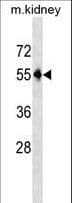 PNPLA3 / Adiponutrin Antibody (aa366-393)