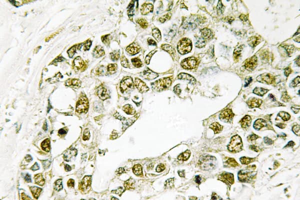 Polyclonal Rabbit anti-Human EIF2S1 Antibody (Ile45, IHC, WB)