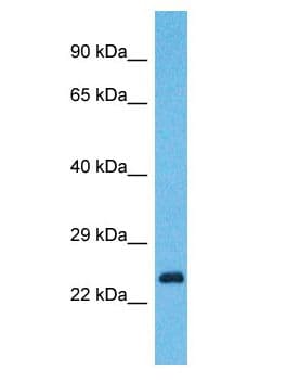 YIPF7 Antibody (aa40-89)