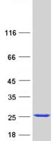 Human UBE2D3 / UBCH5C Protein (Recombinant Myc-DDK (Flag))