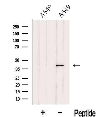ITM2A Antibody