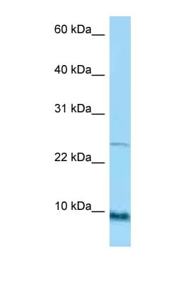 Polyclonal Rabbit anti-Human SPRR1A Antibody (C-Terminus, WB)