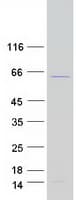 Human PRPF31 Protein (Recombinant Myc-DDK (Flag))