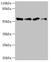 Polyclonal Rabbit anti-Human TFCP2 / CP2 Antibody (IHC, WB)