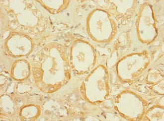 SLC5A2 / SGLT2 Antibody