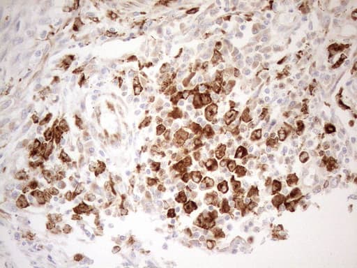 Monoclonal Mouse anti-Human GRN / Granulin Antibody (clone OTI3H6, aa327-593, IHC, WB)