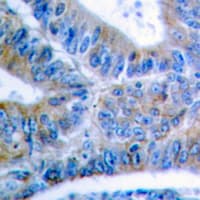 BCL2L1 / BCL-XL Antibody (phospho-Ser62)