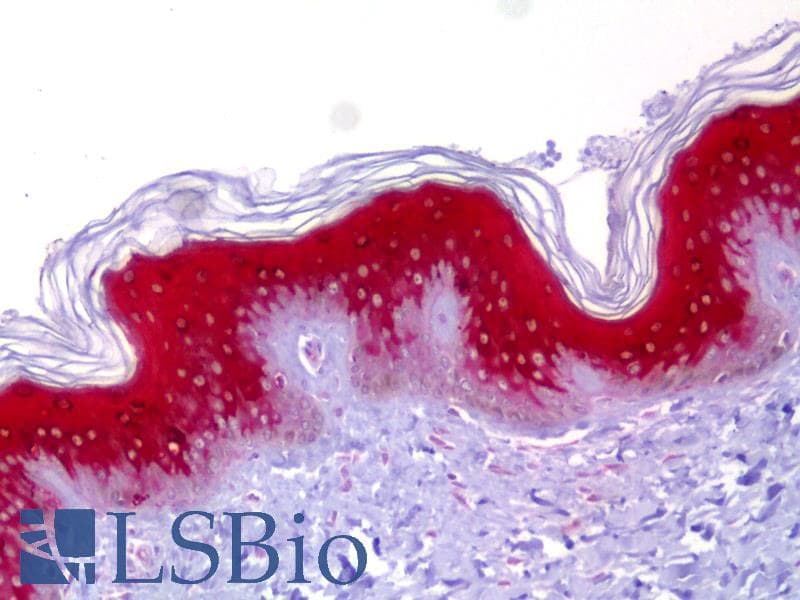 IHC-plus™ IVL / Involucrin Antibody (clone SY5)