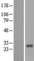 THEM5 Protein (Over-Expression Lysate Myc-DDK (Flag))